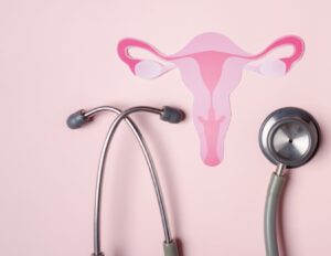 Image of female reproductive system and medical equipment